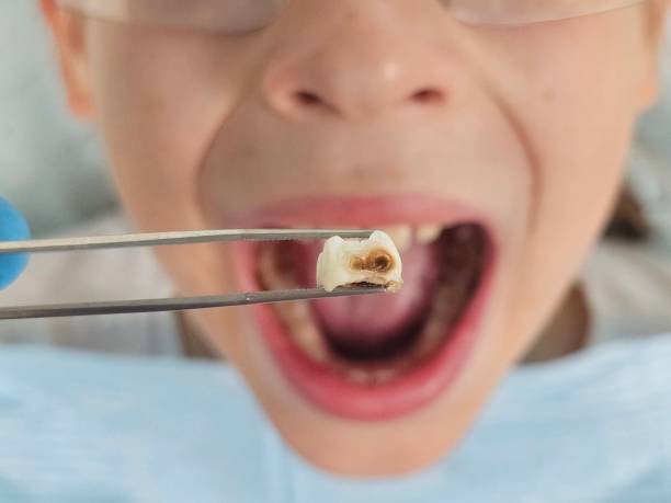 Best Emergency Orthodontic Repairs in Rutland, VT